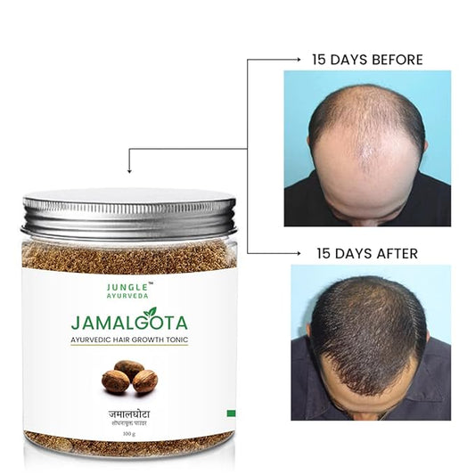 🌿 Jamalgota Ayurvedic Hair Growth Powder Buy 1 Get 1 Free 🌿 100% Natural Hair Growth