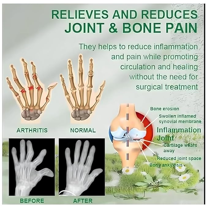 Bee Venom Pain Relief Cream || Bee Venom Joint and Bone Therapy Cream | Ultra Strength Bee Venom Pain Relief Cream (Pack of 2)