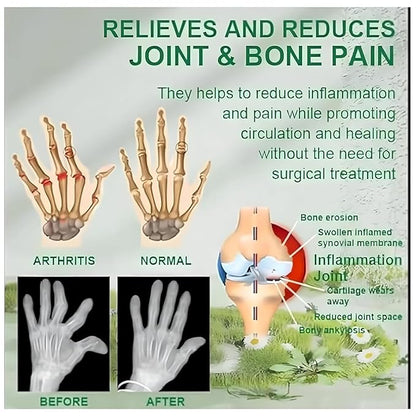 Bee Venom Pain Relief Cream || Bee Venom Joint and Bone Therapy Cream | Ultra Strength Bee Venom Pain Relief Cream (Pack of 2)